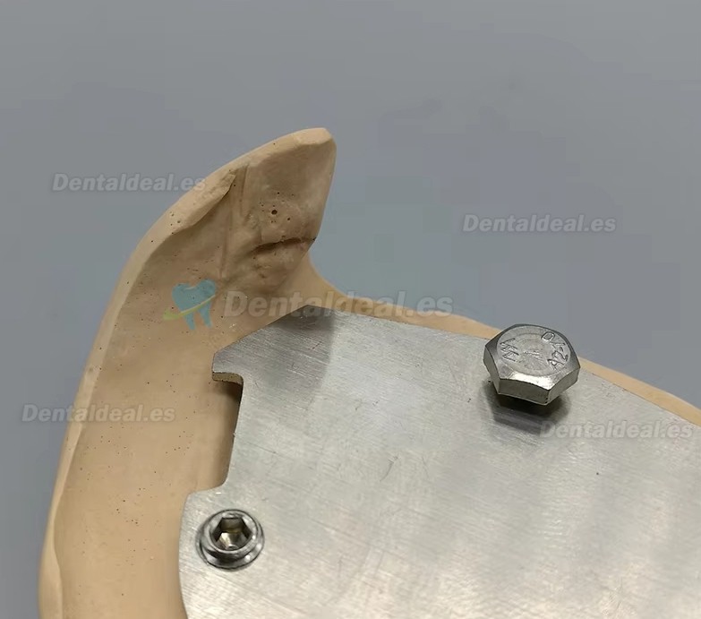 Registrador Relaci&oacute;n C&eacute;ntrica con Trazador Arco G&oacute;tico para Ed&eacute;ntulos